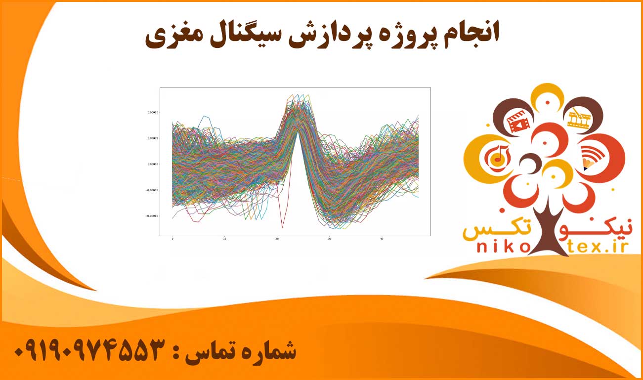 انجام روژه پردازش سیگنال مغزی